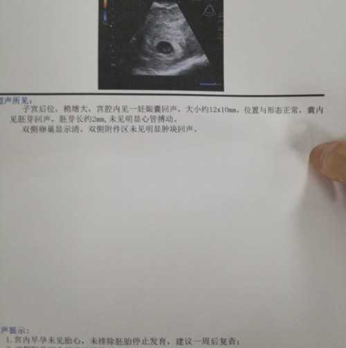 福孕供卵机构（北京供卵代怀）